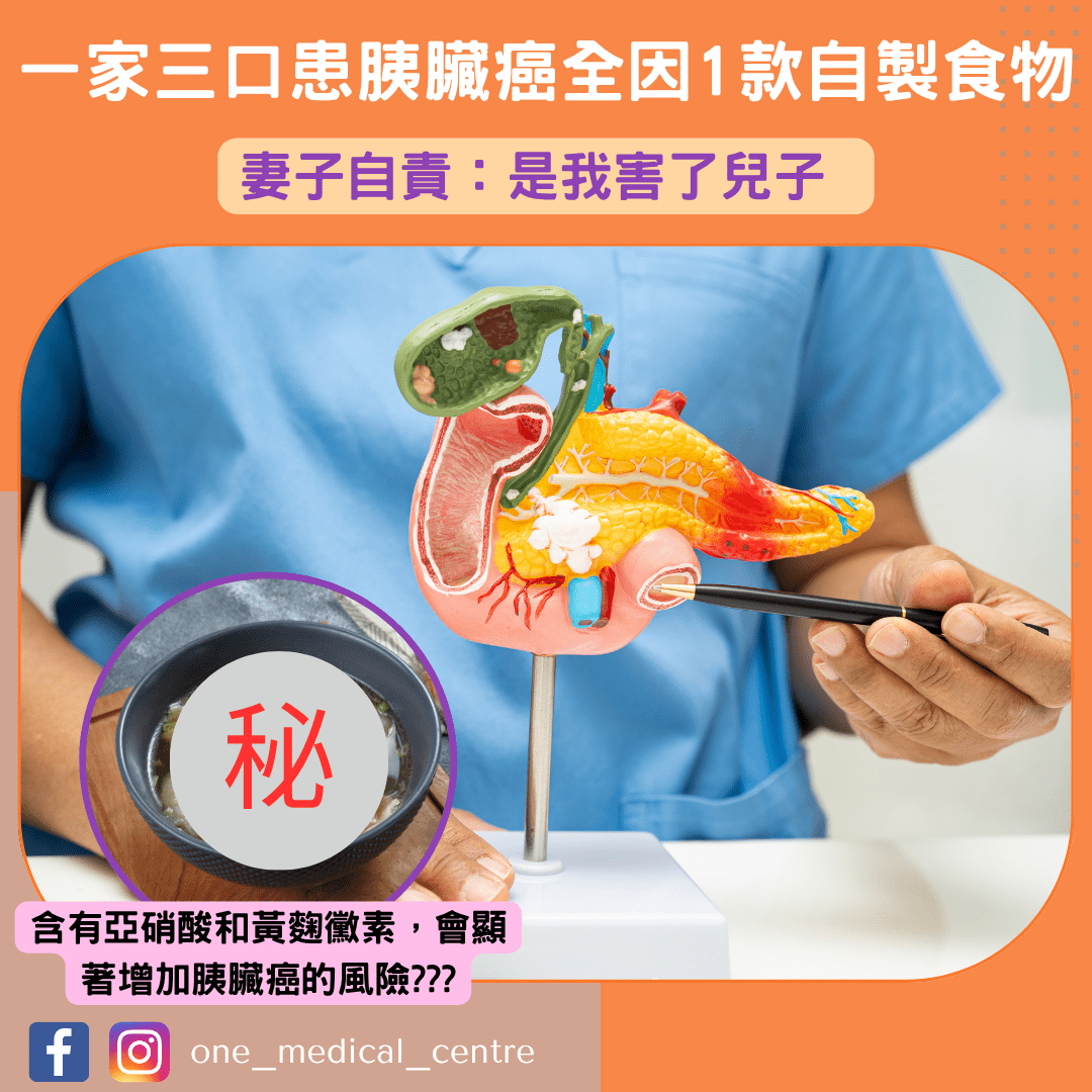【一家三口患胰臟癌全因1款自製食物　妻子自責：是我害了兒子】